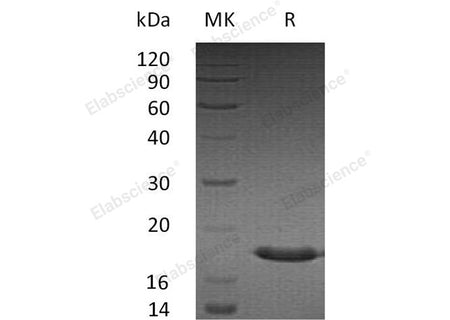 Recombinant Human SUMO3/SMT3A Protein