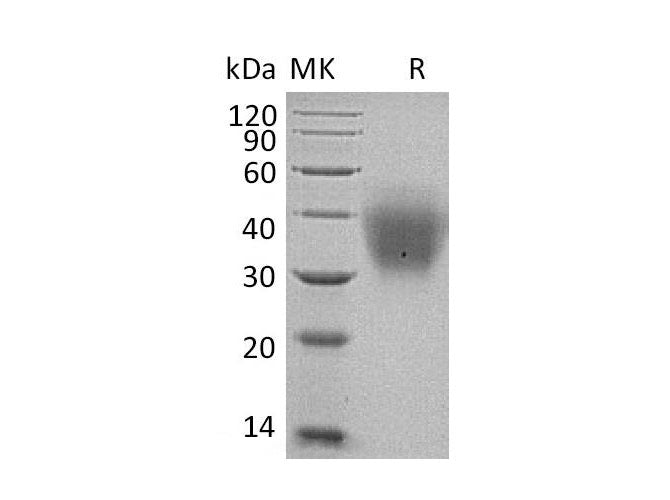 Recombinant Human SCF/c-Kit Ligand Protein (His Tag)(Active)