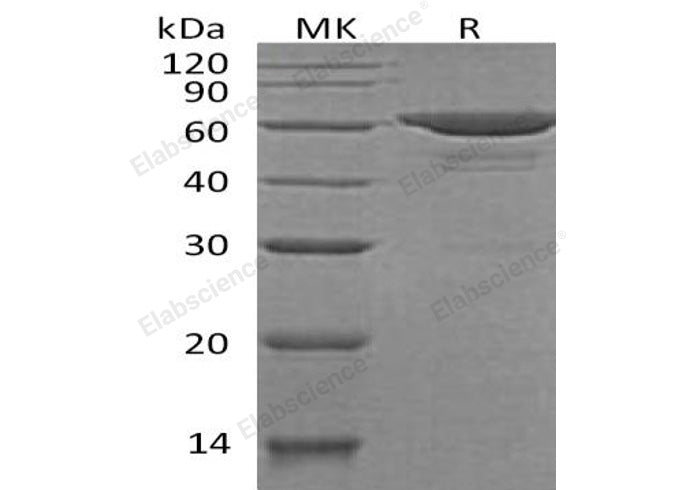 Recombinant Human SOAT2/ACAT2 Protein (His&Trx Tag)