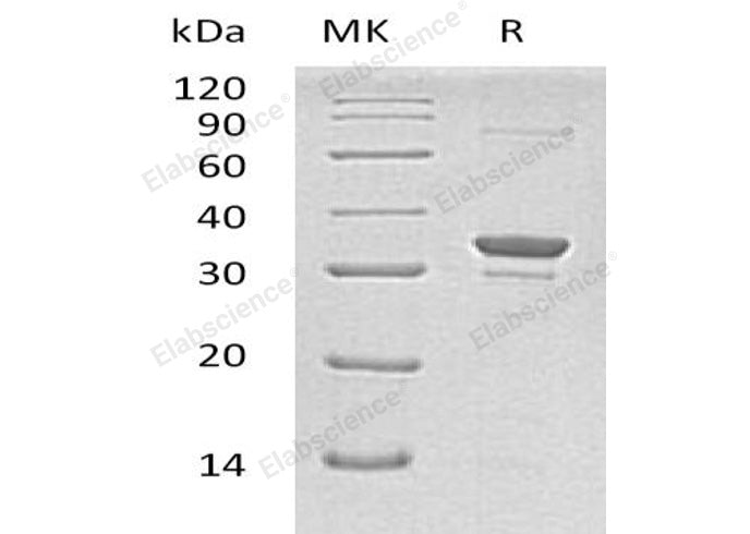 Recombinant Human SULT1A2 Protein (His Tag)