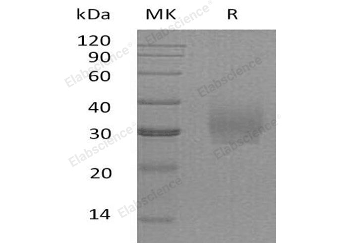 Recombinant Human Syndecan-2/SDC2 Protein (His Tag)(Active)
