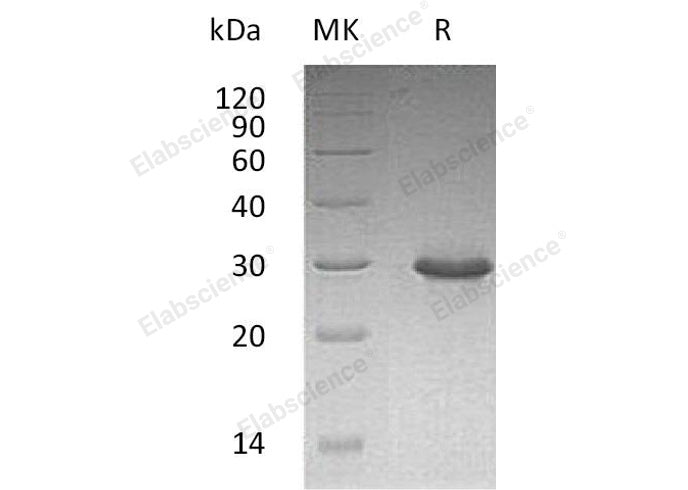 Recombinant Human TRIM/TRAT1 Protein (His Tag)