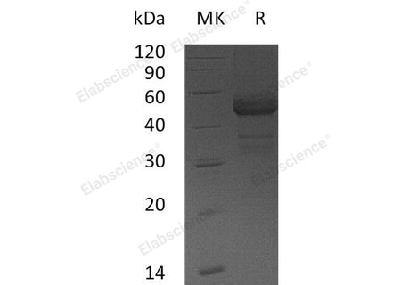 Recombinant Human TDGF1 Protein (Fc Tag)(Active)