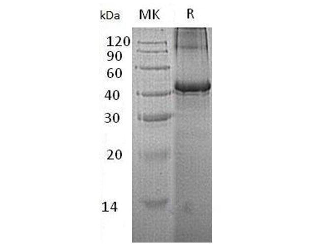 Recombinant Human Testin/TES Protein (His Tag)