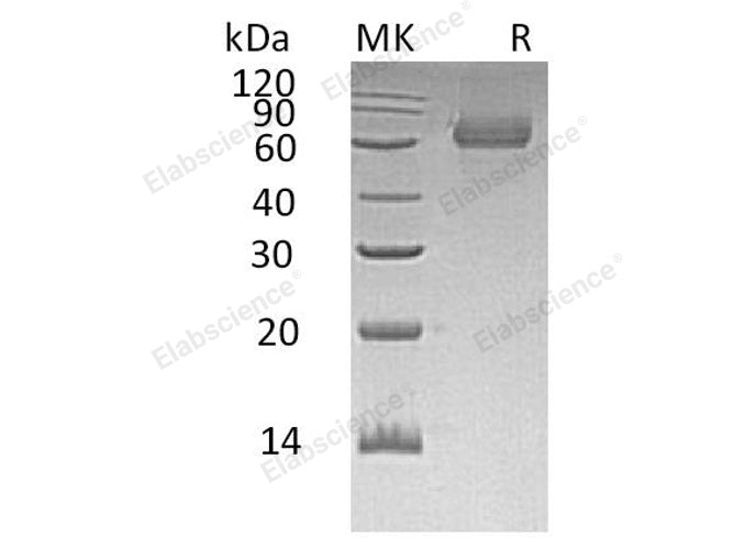 Recombinant Human TGOLN2/TGN38 Homolog Protein (His Tag)