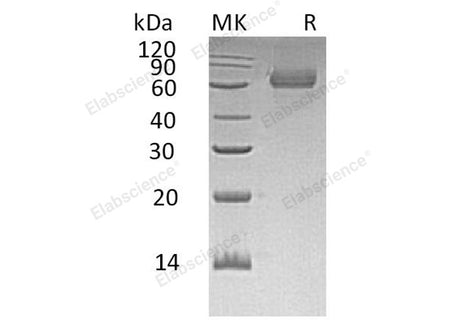 Recombinant Human TGOLN2/TGN38 Homolog Protein (His Tag)