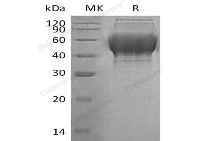 Recombinant Human TXNDC15 Protein (His Tag)