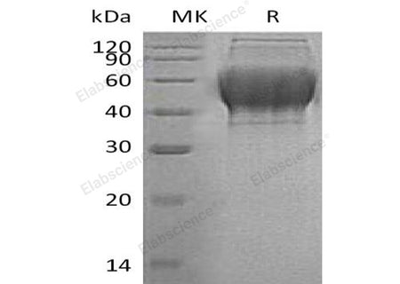 Recombinant Human TXNDC15 Protein (His Tag)