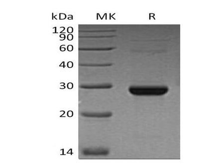 Recombinant Human TK1 Protein (His Tag)
