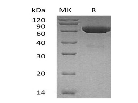 Recombinant Human tPA/PLAT Protein (His Tag)