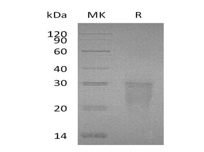 Recombinant Human TMIGD2/IGPR-1 Protein (His Tag)