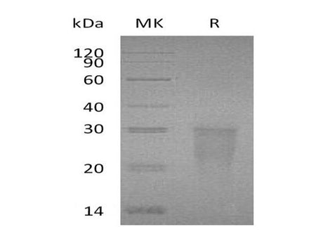Recombinant Human TMIGD2/IGPR-1 Protein (His Tag)