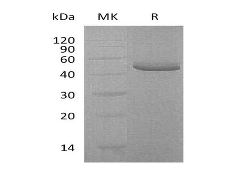 Recombinant Human TRAIL R2/TNFRSF10B Protein (Fc & His Tag)