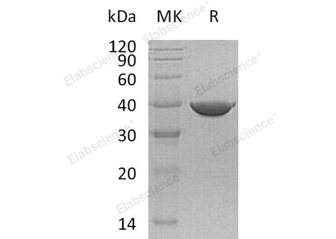 Recombinant Human Transaldolase/TALDO1 Protein (His Tag)
