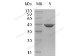 Recombinant Human Transaldolase/TALDO1 Protein (His Tag)