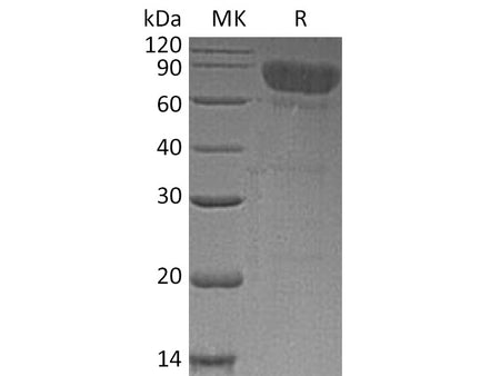Recombinant Human TCblR/8D6A Protein (Fc Tag)