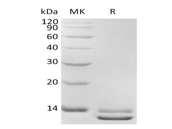 Recombinant Human TGFB3 Protein (Active)