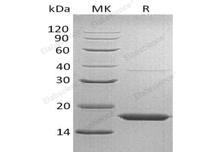 Recombinant Human Transthyretin/TTR Protein (His Tag)