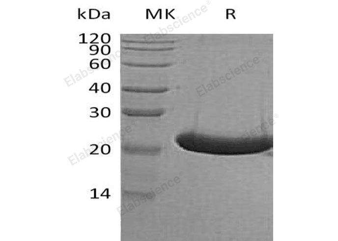 Recombinant Human TREML1/TLT-1 Protein (His Tag)