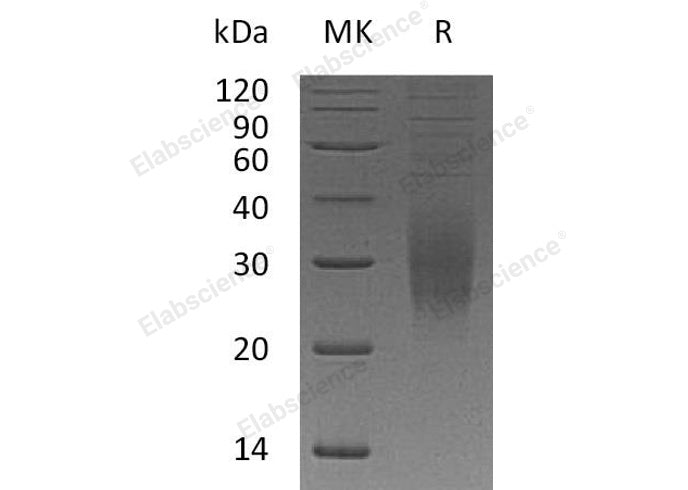 Recombinant Human TREM2 Protein (His Tag)