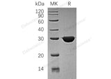 Recombinant Human TPI1/TIM Protein (His Tag)