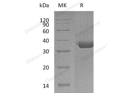 Recombinant Human TPSAB1 Protein (His Tag)