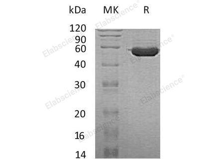 Recombinant Human TINAGL1 Protein (His Tag)