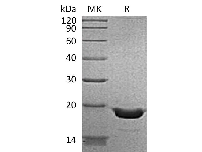 Recombinant Human TNF-alpha/TNFA Protein (aa 57-233, His Tag)(Active)