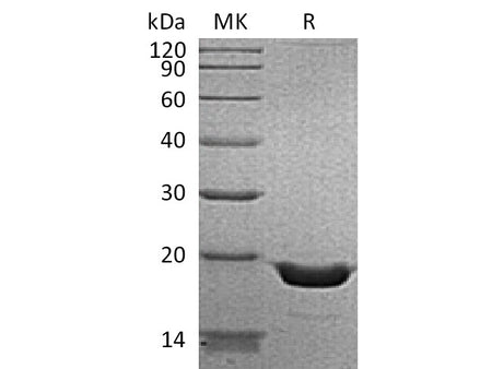 Recombinant Human TNF-alpha/TNFA Protein (aa 57-233, His Tag)(Active)