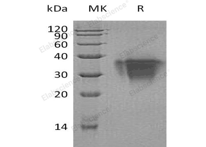 Recombinant Human TWSG1/TSG Protein (His Tag)