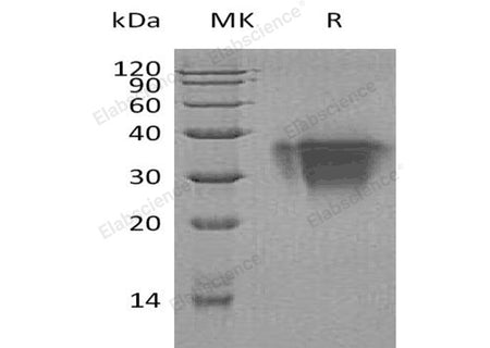 Recombinant Human TWSG1/TSG Protein (His Tag)