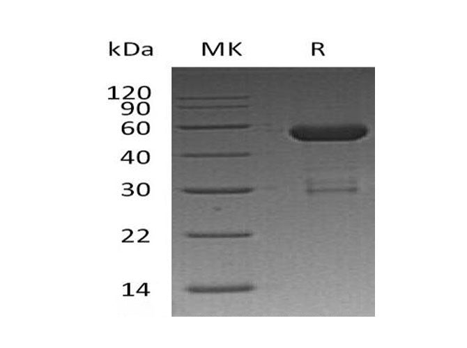 Recombinant Human OTUB2 Protein (GST Tag)