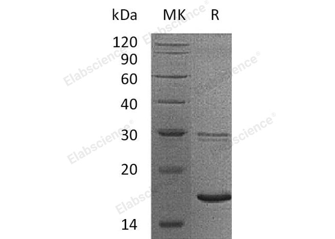 Recombinant Human UBE2B/HR6B Protein (His Tag)