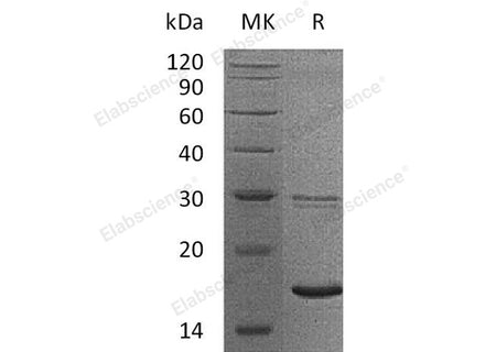 Recombinant Human UBE2B/HR6B Protein (His Tag)