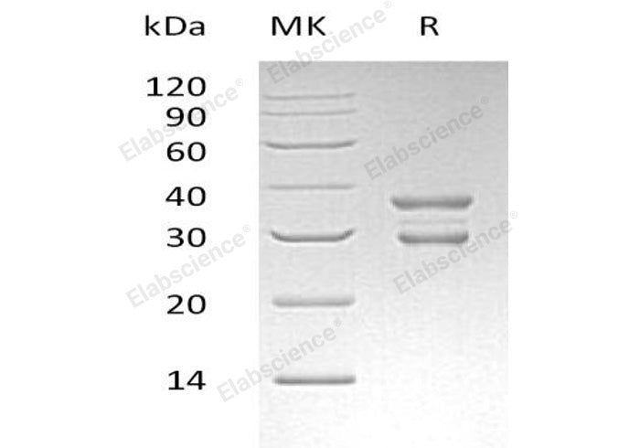 Recombinant Human UBE2J2 Protein (GST Tag)