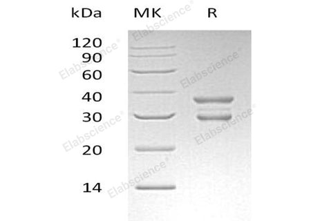 Recombinant Human UBE2J2 Protein (GST Tag)