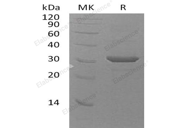 Recombinant Human UBE2Z Protein (His Tag)