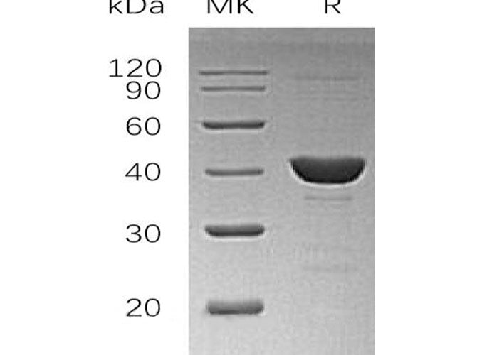 Recombinant Human UROD Protein (His Tag)