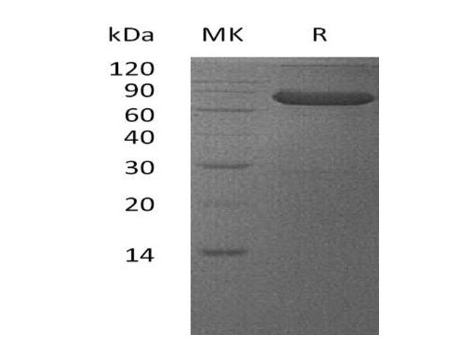 Recombinant Human VSIG4 Protein (Fc Tag)