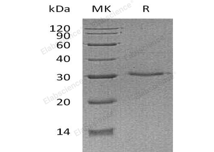 Recombinant Human VSIG8 Protein (His Tag) - MSE Supplies LLC