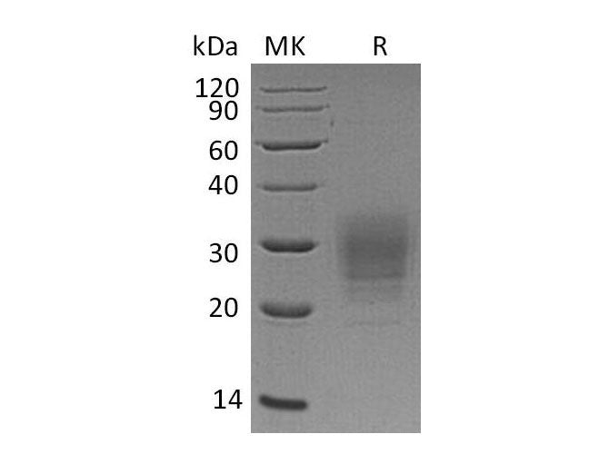 Recombinant Human VSTM1 Protein (His Tag)