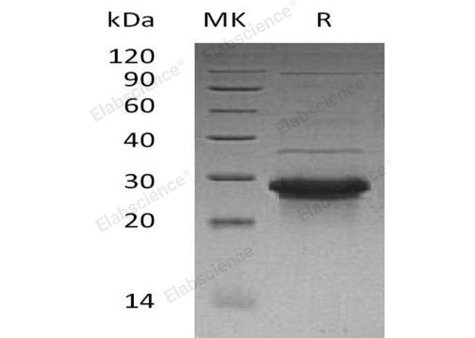 Recombinant Human WBP1 Protein (His Tag)
