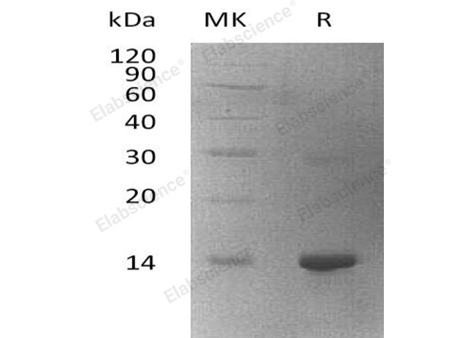 Recombinant Human WBP2 Protein (His Tag)