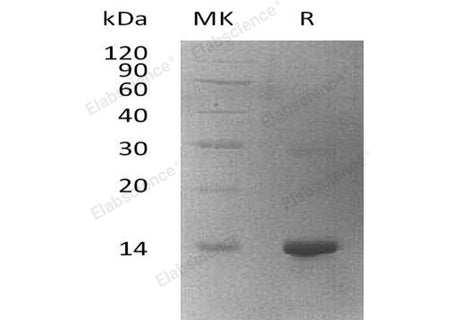 Recombinant Human WBP2 Protein (His Tag)