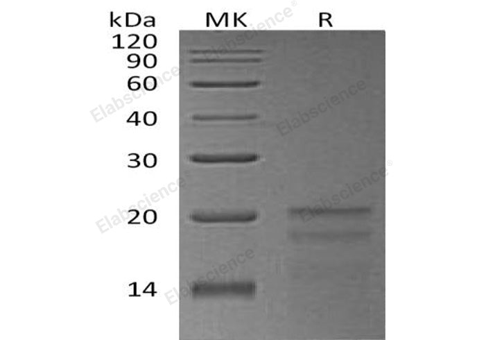 Recombinant Human ZNHIT1 Protein (His Tag)