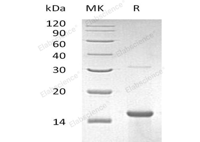 Recombinant Human ZNF100 Protein (His Tag)