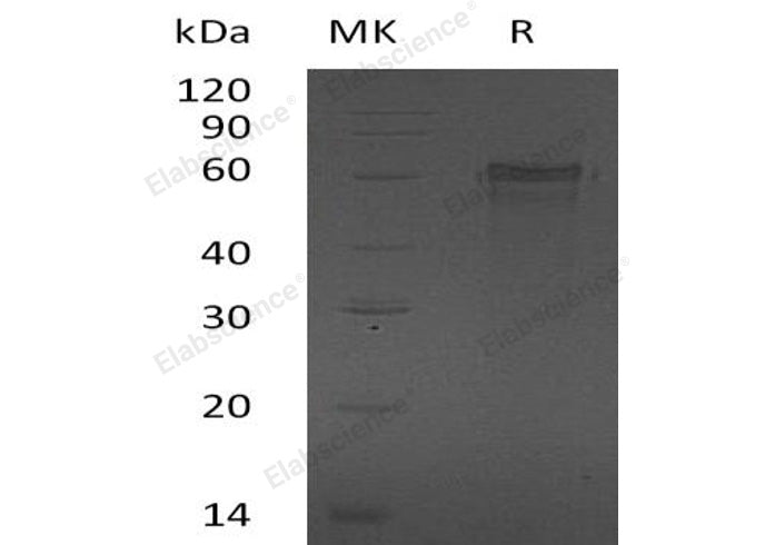 Recombinant Human ZNF70 Protein (His Tag)