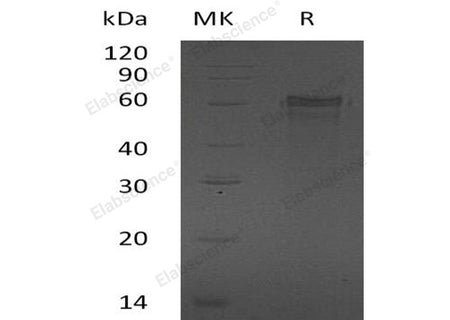 Recombinant Human ZNF70 Protein (His Tag)