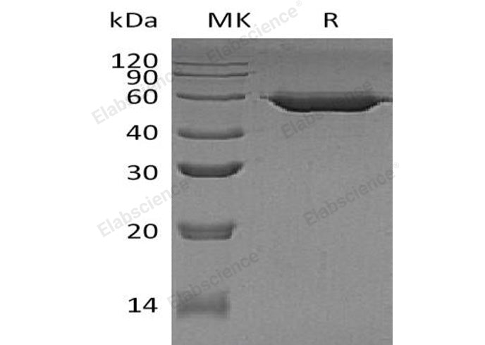 Recombinant Human beta Amylase/AMY2 Protein (His Tag)