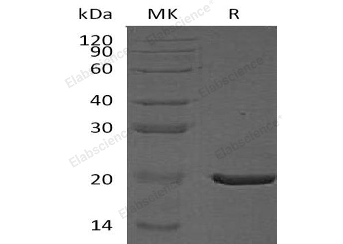Recombinant Human CRYAA Protein (His Tag)